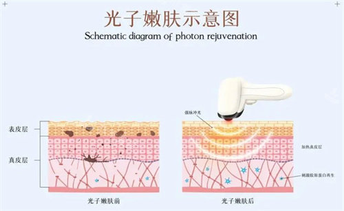 新手接触seo，感觉无所适从